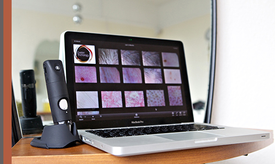 hair loss advice and treatment